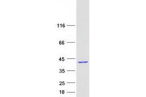 Western Blotting (WB) image for Nudix (Nucleoside Diphosphate Linked Moiety X)-Type Motif 22 (NUDT22) (Transcript Variant 1) protein (Myc-DYKDDDDK Tag) (ABIN2727759)