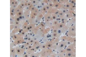 #VALUE! (Leucine Rich Repeats And Death Domain Containing Protein (AA 694-885) 抗体)