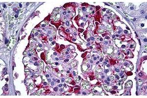 Human Kidney, Glomerulus: Formalin-Fixed, Paraffin-Embedded (FFPE) (S100A6 抗体  (AA 1-91))