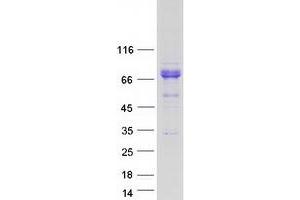 Western Blotting (WB) image for Folliculin (FLCN) (Transcript Variant 1) protein (Myc-DYKDDDDK Tag) (ABIN2721298)