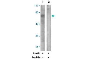 Western blot analysis of extracts from NIH/3T3 cells, treated with Insulin (0. (GRB10 抗体)
