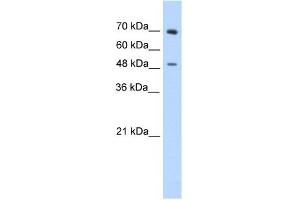 WB Suggested Anti-ZNF821 Antibody Titration:  0. (ZNF821 抗体  (C-Term))