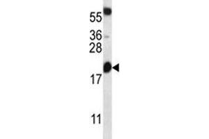 Western Blotting (WB) image for anti-B-Cell CLL/lymphoma 2 (BCL2) (AA 86-114) antibody (ABIN3030099)