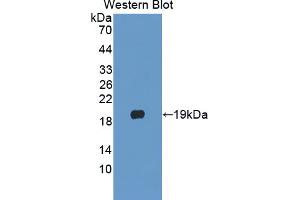 Western blot analysis of the recombinant protein. (PLA2G10 抗体  (AA 32-165))