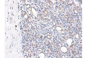 Immunohistochemistry (IHC) image for anti-Chemokine (C-C Motif) Ligand 4 (CCL4) antibody (ABIN2475707) (CCL4 抗体)