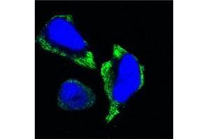 Confocal immunofluorescence analysis of Hela cells using PAK2 antibody (green). (PAK2 抗体)