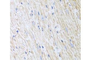 Immunohistochemistry of paraffin-embedded Mouse heart using RCN2 Polyclonal Antibody at dilution of 1:100 (40x lens). (RCN2 抗体)