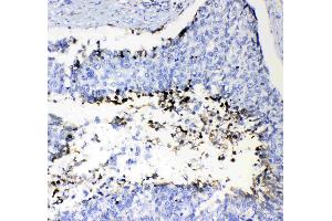 IHC analysis of Prothrombin  using anti-Prothrombin  antibody . (Prothrombin 抗体  (AA 67-124))