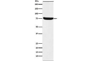 Western blot analysis of HTF9C expression in A431 cell lysate.