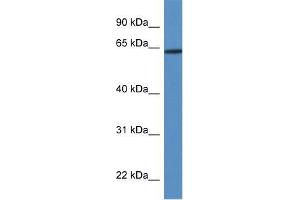 Human Jurkat; WB Suggested Anti-HOXD3 Antibody Titration: 0. (HOXD3 抗体  (Middle Region))