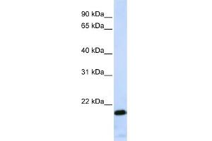 WB Suggested Anti-ZNF428 Antibody Titration:  0. (ZNF428 抗体  (Middle Region))