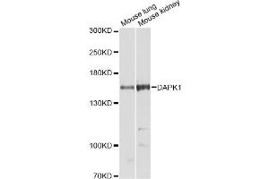Western blot analysis of extracts of various cell lines, using DAPK1 Antibody (ABIN5973367) at 1/1000 dilution. (DAP Kinase 1 抗体)