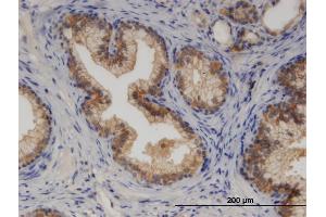 Immunoperoxidase of monoclonal antibody to CYP7B1 on formalin-fixed paraffin-embedded human prostate. (CYP7B1 抗体  (AA 203-286))