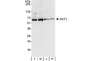Western Blotting (WB) image for anti-V-Akt Murine Thymoma Viral Oncogene Homolog 1 (AKT1) (AA 25-75) antibody (ABIN7454546)