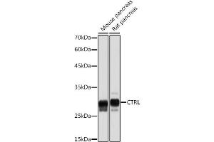 Western blot analysis of extracts of various cell lines, using CTRL Rabbit mAb (ABIN7266395) at 1:5000 dilution. (Chymotrypsin 抗体)
