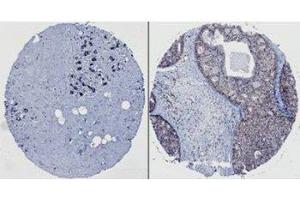 Image no. 3 for anti-Neural Precursor Cell Expressed, Developmentally Down-Regulated 9 (NEDD9) (AA 82-398) antibody (ABIN108573)