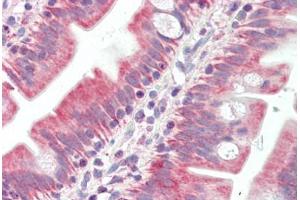 anti-BCL2-Antagonist/killer 1 (BAK1) antibody