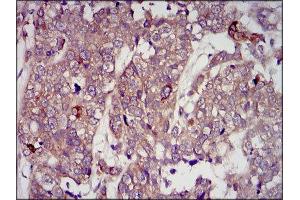 Immunohistochemistry (IHC) image for anti-Insulin-Like Growth Factor 2 (IGF2) (AA 25-180) antibody (ABIN1846026) (IGF2 抗体  (AA 25-180))