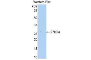 Western Blotting (WB) image for anti-alpha-2-Macroglobulin (A2M) (AA 216-437) antibody (ABIN1077782) (alpha 2 Macroglobulin 抗体  (AA 216-437))