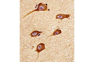 Immunohistochemistry (Paraffin-embedded Sections) (IHC (p)) image for anti-ATPase, Ca++ Transporting, Ubiquitous (ATP2A3) (AA 13-47) antibody (ABIN6242174)