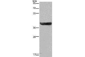 Western blot analysis of Human fetal liver tissue, using HSD17B2 Polyclonal Antibody at dilution of 1:300 (HSD17B2 抗体)