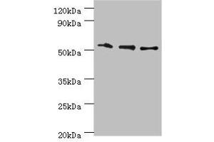 Western blot All lanes: RMDN3 antibody at 4 μg/mL Lane 1: Hela whole cell lysate Lane 2: MCF-7 whole cell lysate Lane 3: Mouse liver tissue Secondary Goat polyclonal to rabbit IgG at 1/10000 dilution Predicted band size: 53, 39 kDa Observed band size: 53 kDa (RMDN3 抗体  (AA 171-470))