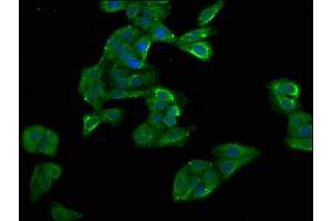 Immunofluorescence staining of HepG2 cells with ABIN7154468 at 1:100, counter-stained with DAPI. (GADD45B 抗体  (AA 1-160))