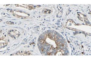 Immunohistochemistry (IHC) image for anti-Protein tyrosine Phosphatase Type IVA, Member 2 (PTP4A2) (Internal Region) antibody (ABIN6264514)