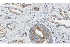 ABIN6278142 at 1/100 staining Human prostate tissue by IHC-P. (PTP4A2 抗体  (Internal Region))