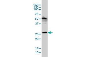 MGC10540 monoclonal antibody (M01), clone 2E5-2B9 Western Blot analysis of MGC10540 expression in Hela S3 NE . (VPS25 抗体  (AA 1-176))