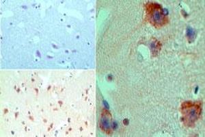 Image no. 1 for anti-Histone Deacetylase 9 (HDAC9) (AA 100-150) antibody (ABIN960197) (HDAC9 抗体  (AA 100-150))