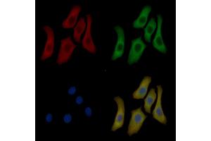 Annexin A2 Mouse Monoclonal Antibody staining Hela cells by IF/ICC. (Annexin A2 抗体  (Internal Region))