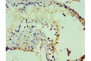 IHC analysis of paraffin-embedded human kidney tissue, using ASH2L antibody (1/100 dilution). (ASH2L 抗体  (AA 1-534))
