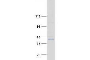 Western Blotting (WB) image for Zinc Finger, DHHC-Type Containing 15 (ZDHHC15) protein (Myc-DYKDDDDK Tag) (ABIN2735813)