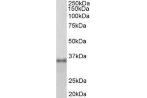 Western Blotting (WB) image for anti-Fibrillarin (FBL) (Internal Region) antibody (ABIN1107198) (Fibrillarin 抗体  (Internal Region))