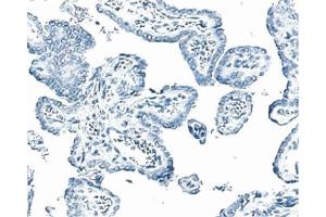 Formalin-fixed, paraffin-embedded tissue section of mouse thyroid stained with a mouse IgM isotype control. (ERBB3 抗体)