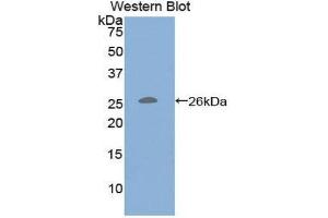 Western Blotting (WB) image for anti-CD79b Molecule, Immunoglobulin-Associated beta (CD79B) (AA 37-226) antibody (ABIN1859292) (CD79b 抗体  (AA 37-226))