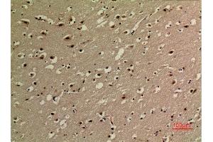 Immunohistochemistry (IHC) analysis of paraffin-embedded Human Brain, antibody was diluted at 1:100. (NF-kB p65 抗体  (acLys314, acLys315))