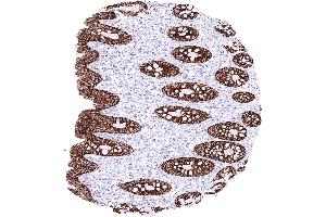 Rectum mucosa with a strong membranous CLDN3 staining of all epithelial cells (Recombinant Claudin 3 抗体  (Intracellular))