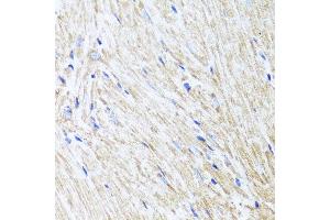 Immunohistochemistry of paraffin-embedded mouse heart using L2HGDH antibody at dilution of 1:100 (x40 lens). (L2HGDH 抗体)