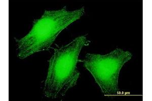 Immunofluorescence of purified MaxPab antibody to LARP6 on HeLa cell. (LARP6 抗体  (AA 1-491))