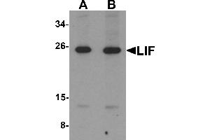 Western blot analysis of LIF in 3T3 cell lysate with LIF antibody at (A) 1 and (B) 2 µg/mL. (LIF 抗体  (Middle Region))