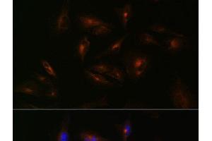 Immunofluorescence analysis of U-251 MG cells using ABCA2 Polyclonal Antibody at dilution of 1:100 (40x lens). (ABCA2 抗体)