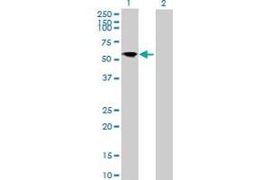 Western Blot analysis of FRS3 expression in transfected 293T cell line by FRS3 MaxPab polyclonal antibody. (FRS3 抗体  (AA 1-492))