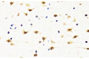 Immunohistochemistry of paraffin-embedded Rat brain using TIA1 Polyclonal Antibody at dilution of 1:100 (40x lens).