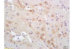 Formalin-fixed and paraffin embedded rat brain labeled with Rabbit Anti CYP5A1/Thromboxane synthase Polyclonal Antibody, Unconjugated (ABIN726065) at 1:200 followed by conjugation to the secondary antibody and DAB staining (PACAP-27/38 (AA 132-169) 抗体)