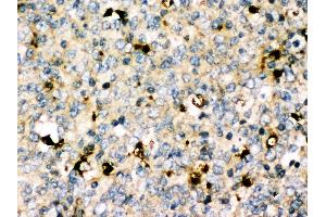 Anti-MyD88 antibody, IHC(P) IHC(P): Human Tonsil Tissue (MYD88 抗体  (Middle Region))
