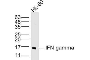 HL-60 lysates probed with IFN gamma Polyclonal Antibody, Unconjugated  at 1:300 dilution and 4˚C overnight incubation.