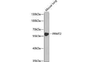 Western blot analysis of extracts of mouse lung, using PRMT2 antibody (ABIN6127447, ABIN6146227, ABIN6146228 and ABIN6221530) at 1:1000 dilution. (PRMT2 抗体  (AA 1-300))