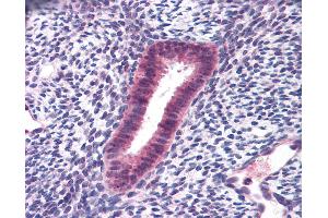 Anti-FOXN1 antibody IHC of human uterus.
